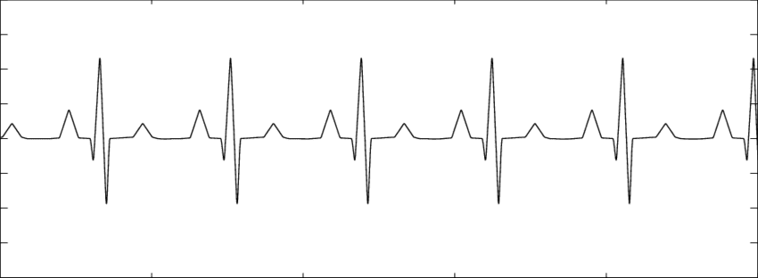 сърдечен пулс, ЕКГ, кардиограма | Д-р Камен Каменов и екип