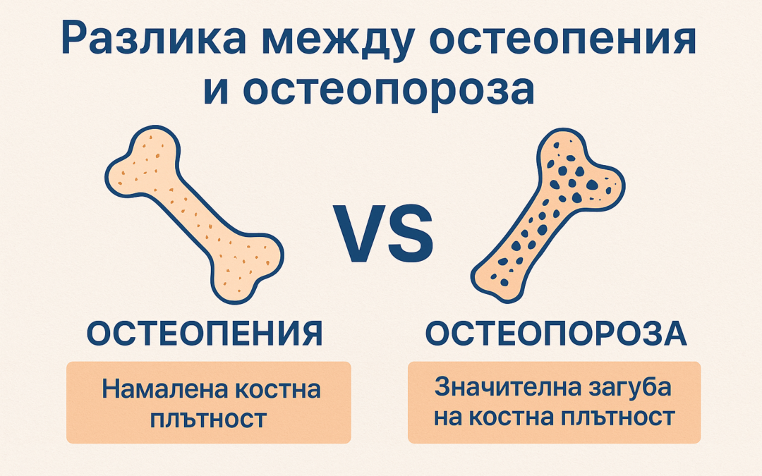 Разлика между остеопения и остеопороза: симптоми, причини и превенция